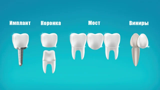 Сравнение видов протезов: что выбрать — объясняю простым языком