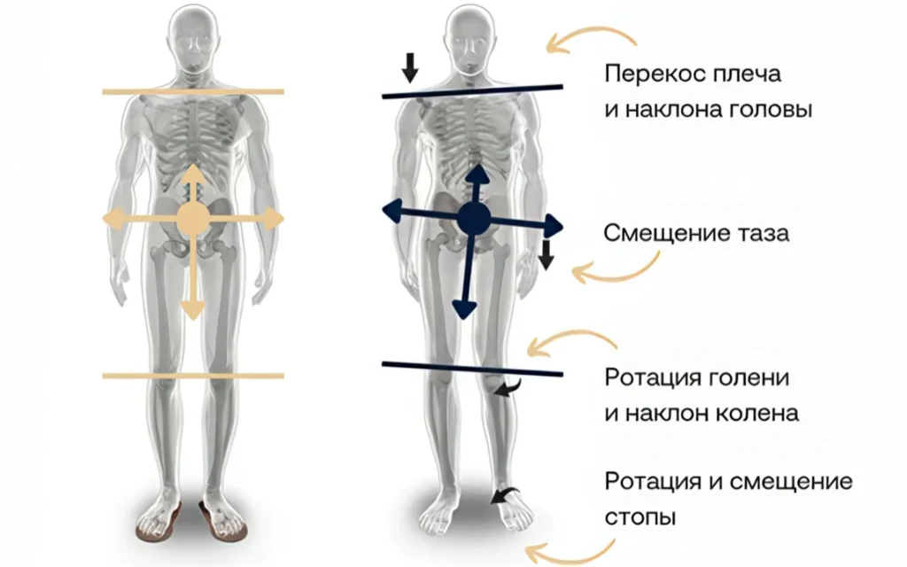 прикус влияет не только на красивую улыбку, но и осанку